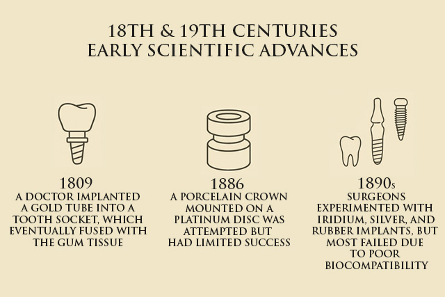 cost of teeth implant
