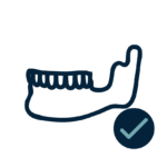an icon of jaw bone for dental implants