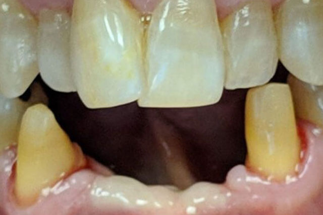 dentist near tracy ca