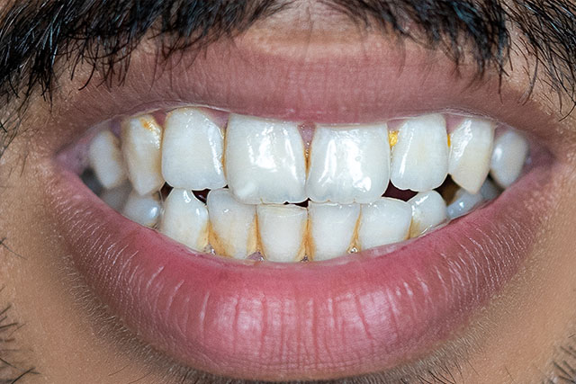 dentist near oakdale ca