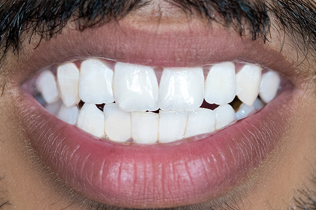 dentist near riverbank ca