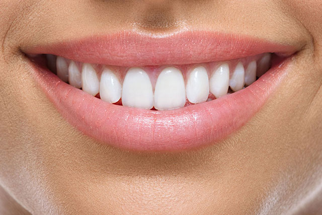 teeth whitening by our dentist near tracy ca